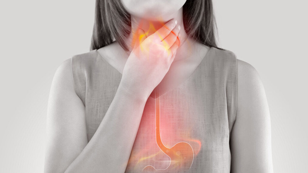 La fisioterapia per ernia iatale e reflusso